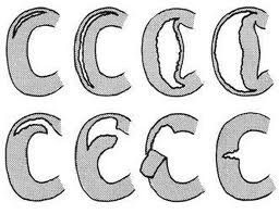 ¿Cuál os parece suturable?